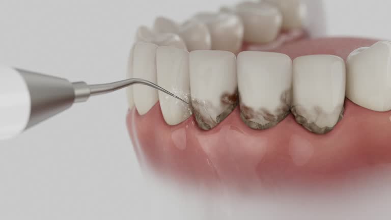 Reliable Tooth Extraction contractor in Warren County County, GA by Dentist Open Now